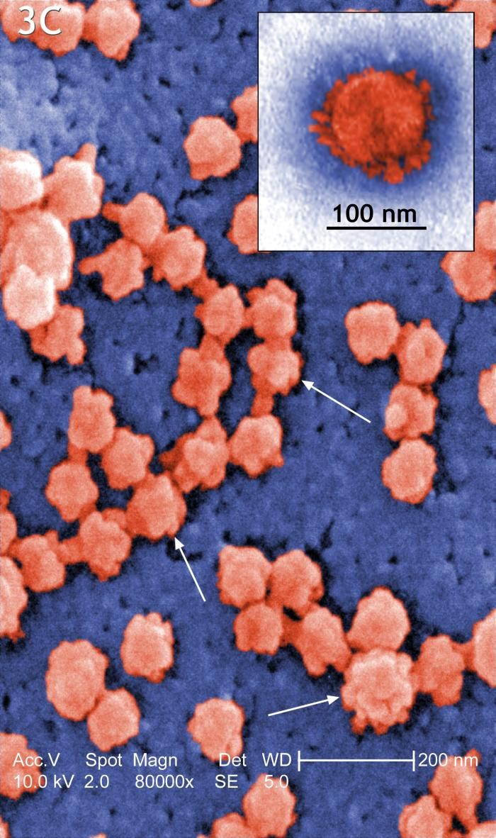 Le coronavirus cousin du Sras infecte son onzième patient